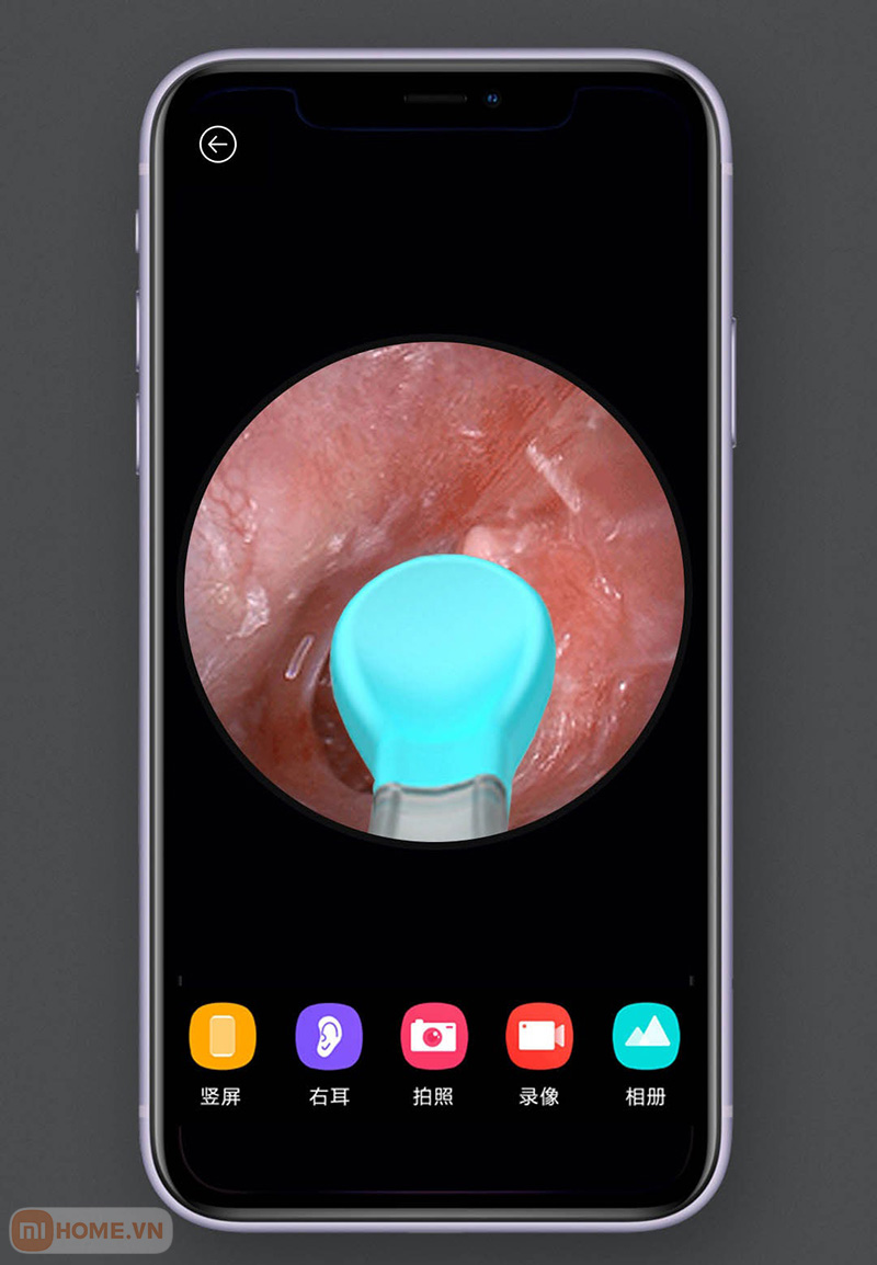 Bo lay ray tai thong minh Xiaomi Bebird M9 Pro 7